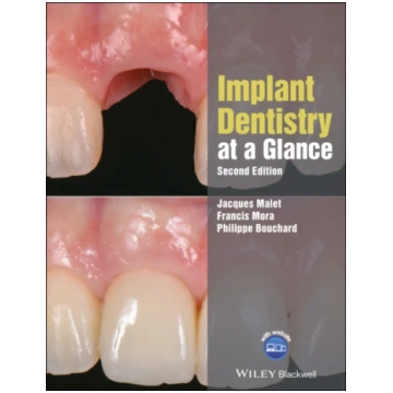 Implant Dentistry at a Glance Jacques Malet