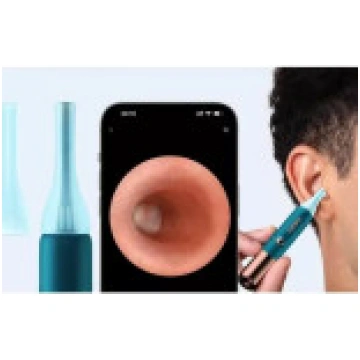Bebird otoskops ar BEBIRD Earsight Ultra kameru [O